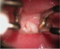 /album/fotogaleria-colposcopia/nicii-endocervical-jpg/